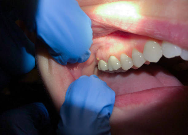 Best Emergency Dental Services for Seniors in Denton, NC