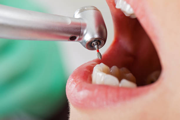 Best Holiday Emergency Dentist in Denton, NC